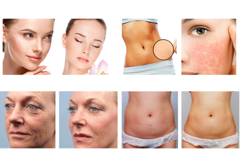 AmBeauteTech Aesthetic Solutions