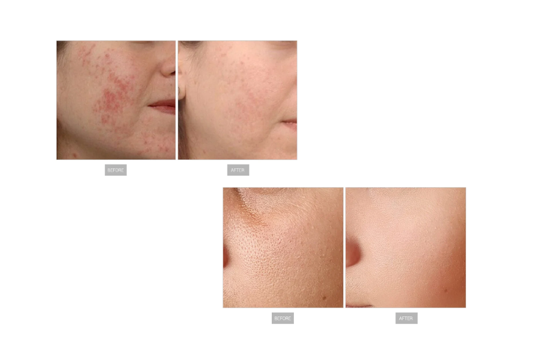 AmBeauteTech Aesthetic Solutions