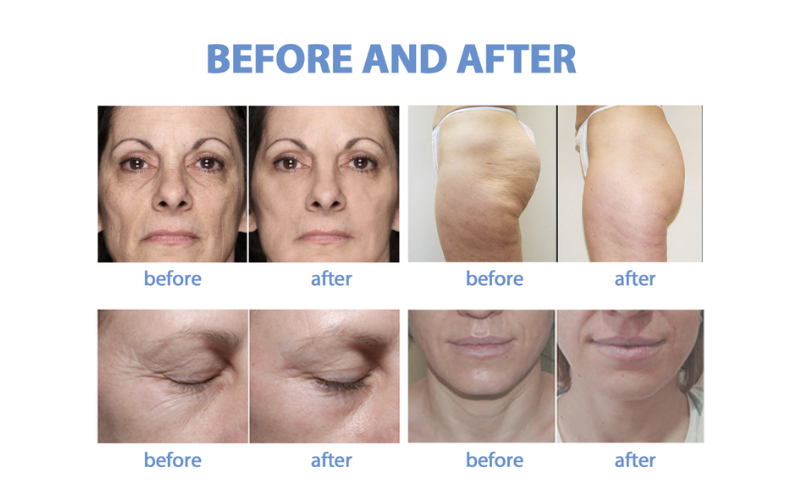 AmBeauteTech Aesthetic Solutions