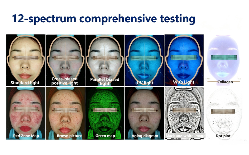 3rd generation AI skin analyzer with iPhone and iPad support for beauty clinics